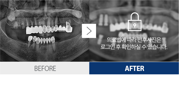 ġ������-1