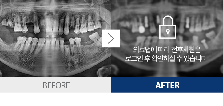 ġ������-2