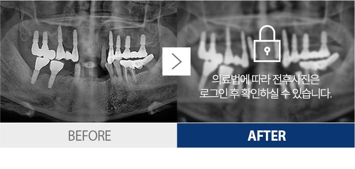 ġ������-3