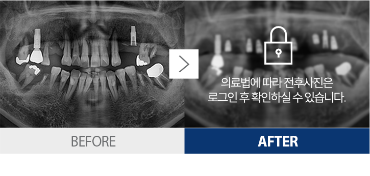 ġ������-4