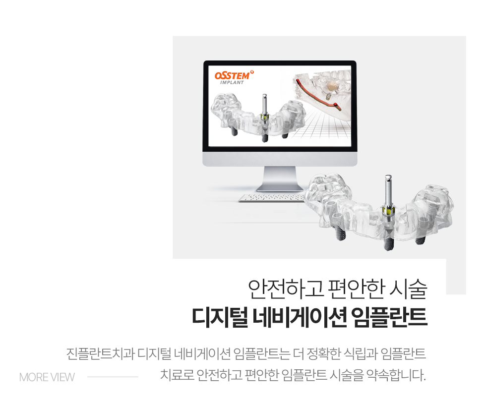 �����ϰ� ������ �ü�