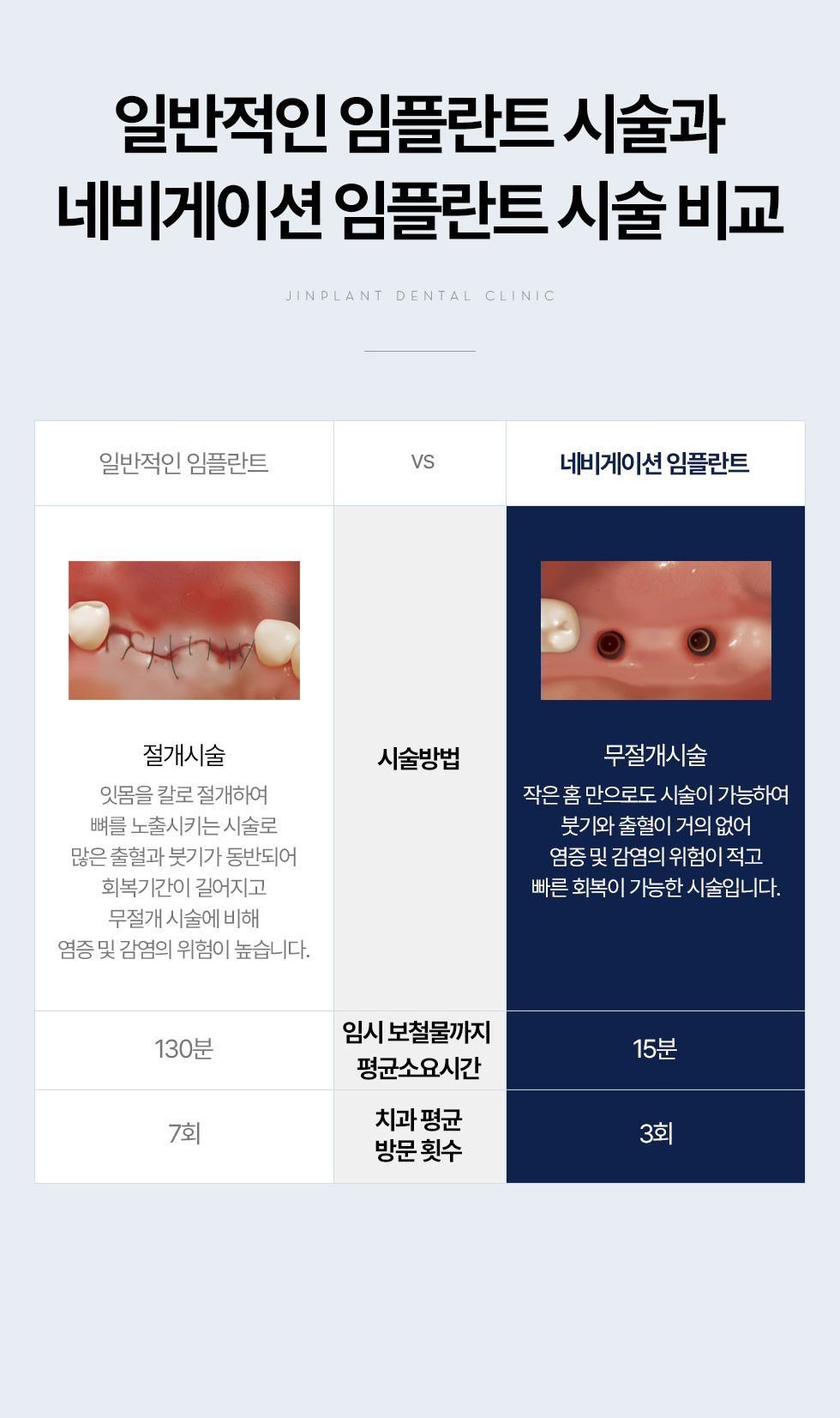 �Ϲ����� ���ö�Ʈ �ü��� �׺���̼� ���ö�Ʈ �ü� ��