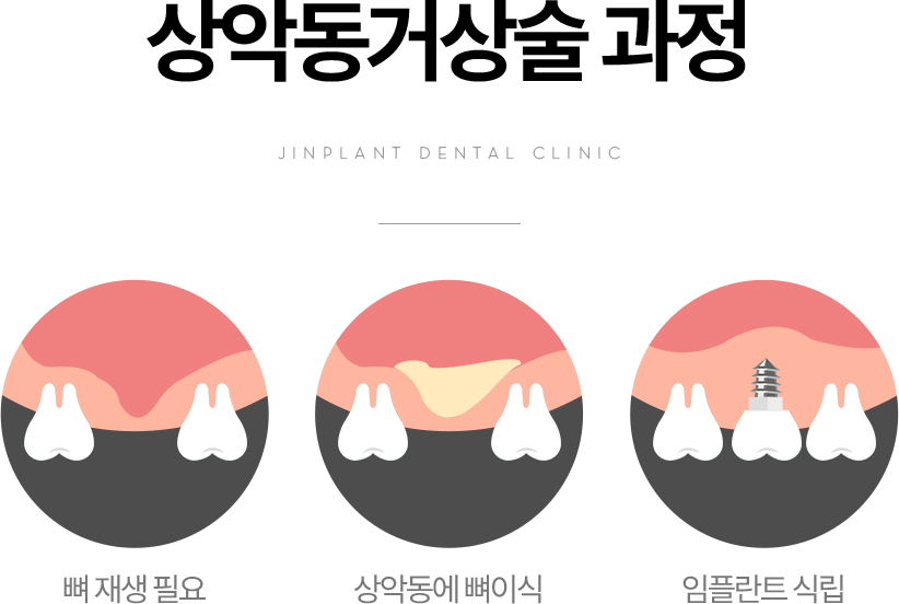 ��ǵ��Ż�� ����