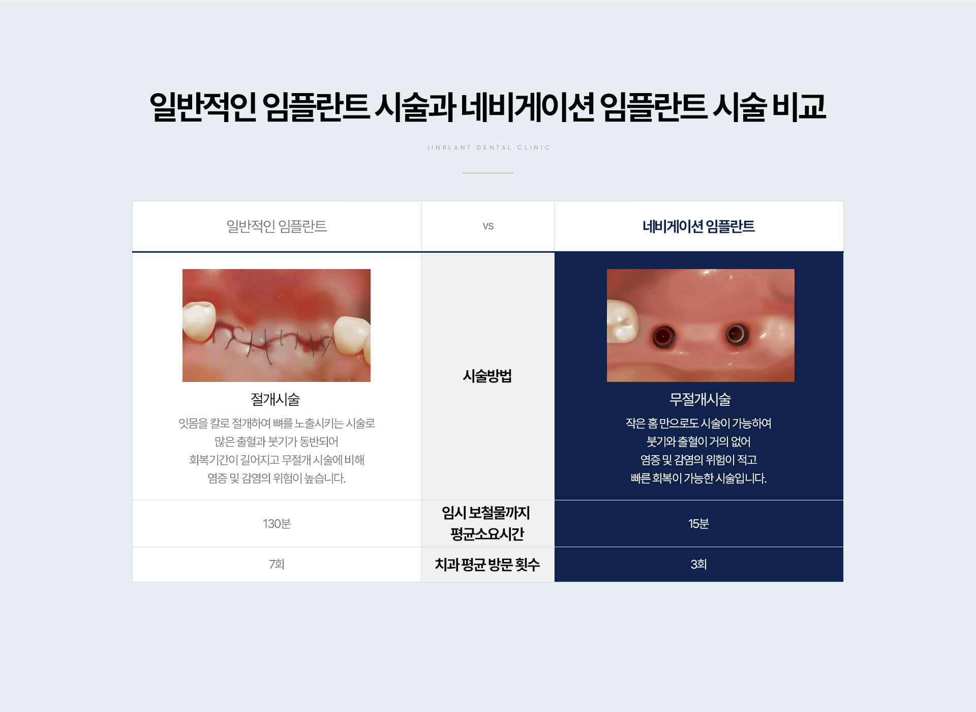 �Ϲ����� ���ö�Ʈ �ü��� �׺���̼� ���ö�Ʈ �ü� ��