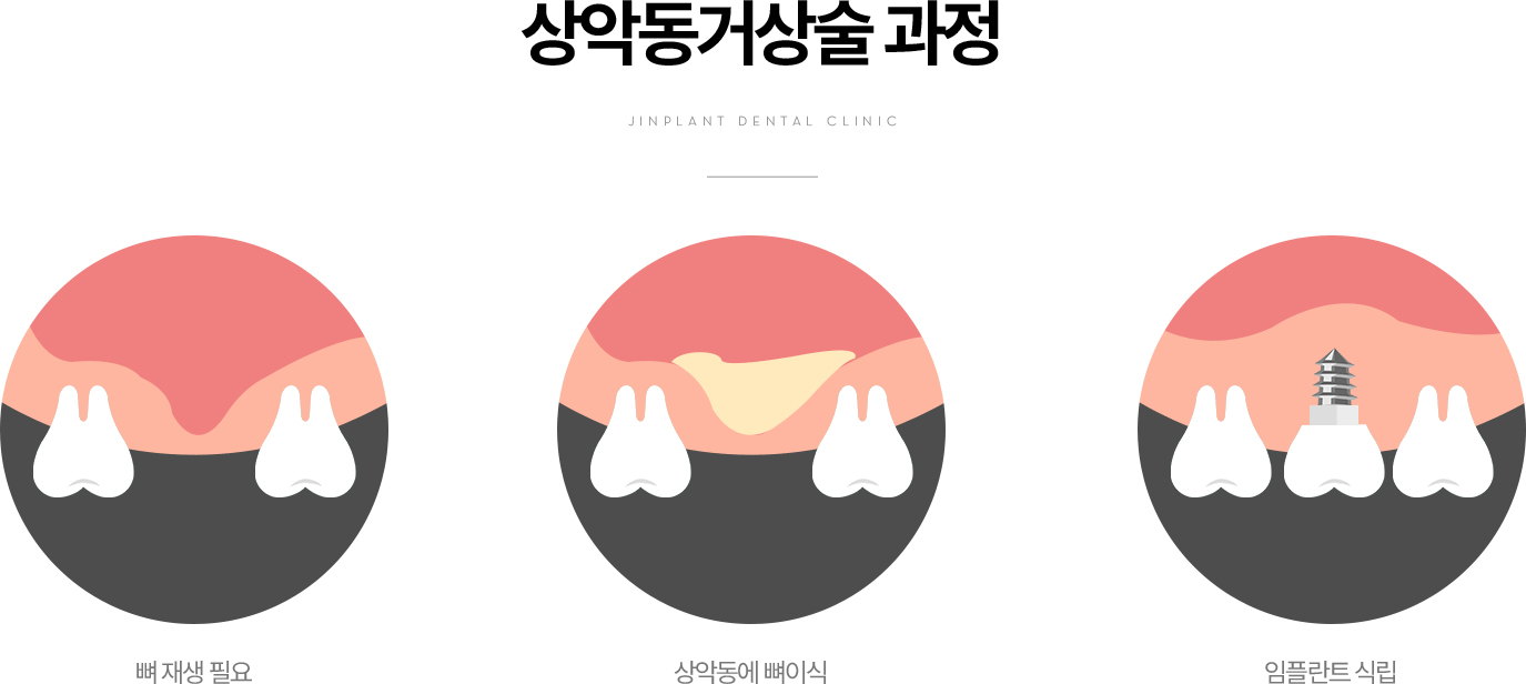 ��ǵ��Ż�� ����